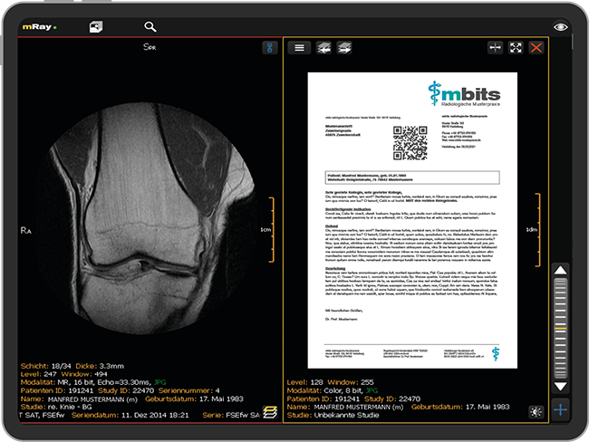 mRay Patientenportal iPad