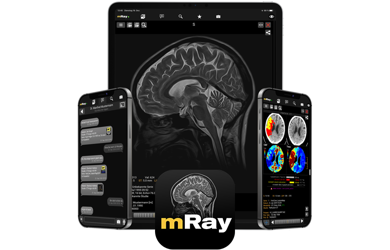 mRay on mobile devices